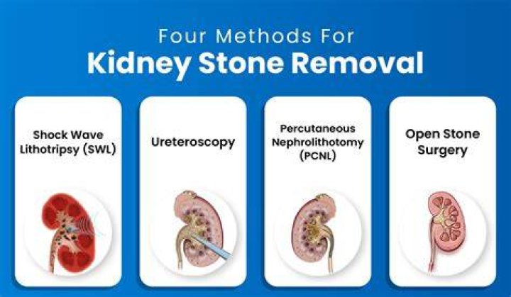 How do they remove a large kidney stone from the bladder?